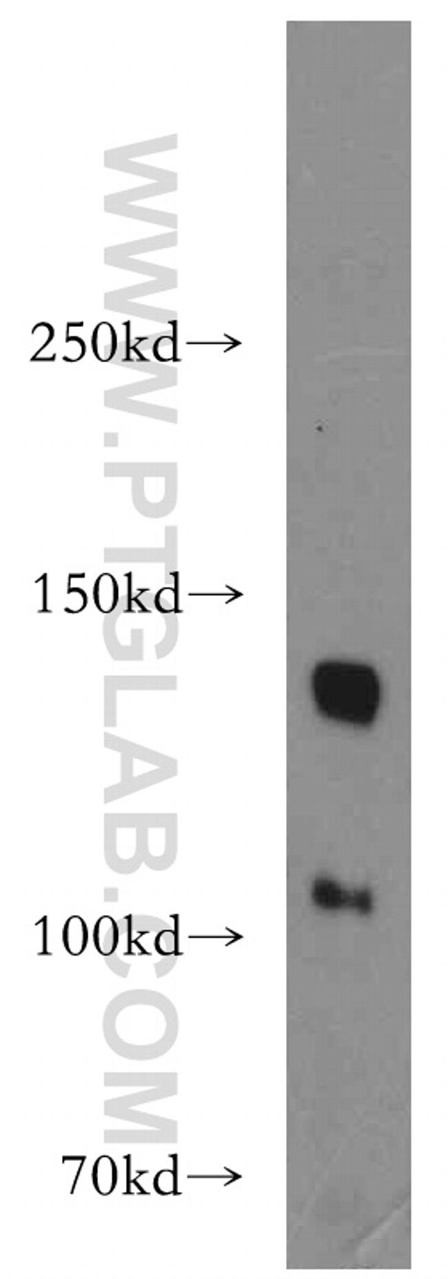 TGFBR3 Antibody in Western Blot (WB)