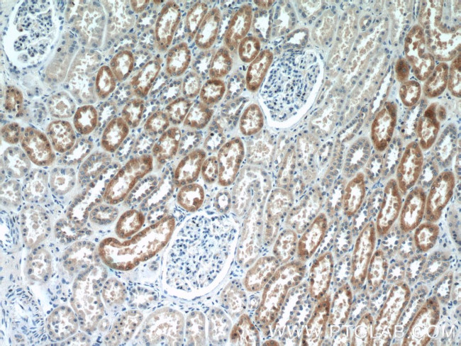 CYP4F8 Antibody in Immunohistochemistry (Paraffin) (IHC (P))