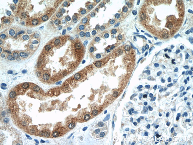 CYP4F8 Antibody in Immunohistochemistry (Paraffin) (IHC (P))