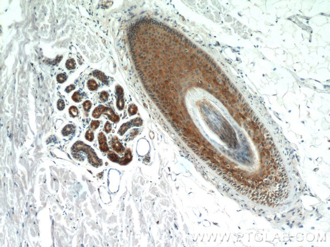 CYP4F8 Antibody in Immunohistochemistry (Paraffin) (IHC (P))