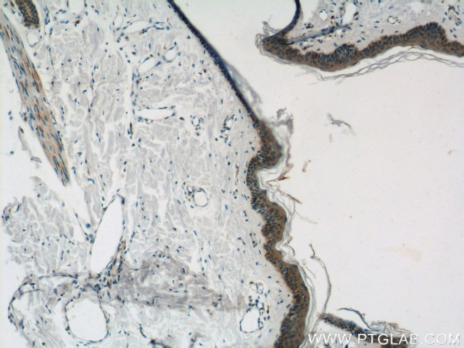 CYP4F8 Antibody in Immunohistochemistry (Paraffin) (IHC (P))