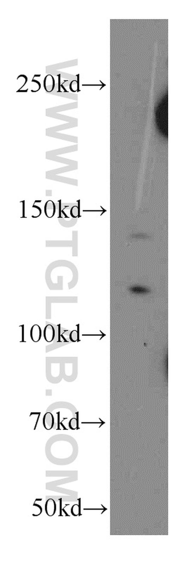 NCOR1 Antibody in Western Blot (WB)