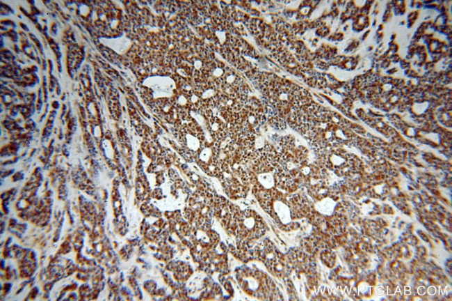 NCOR1 Antibody in Immunohistochemistry (Paraffin) (IHC (P))