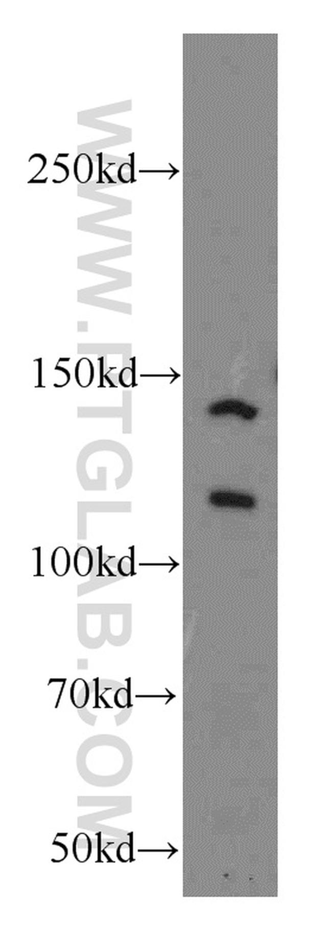 NCOR1 Antibody in Western Blot (WB)