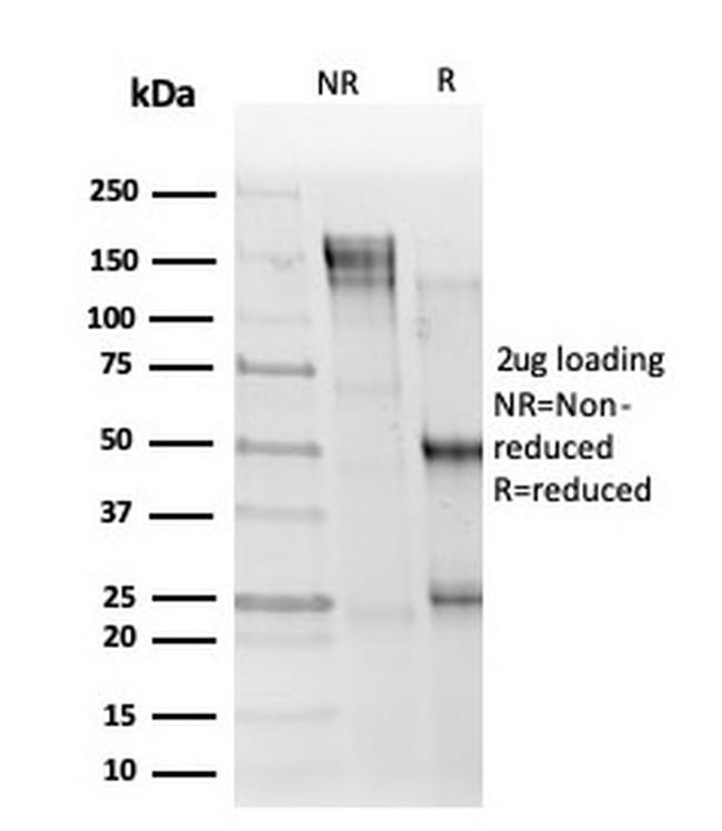 ELK1 Antibody in SDS-PAGE (SDS-PAGE)