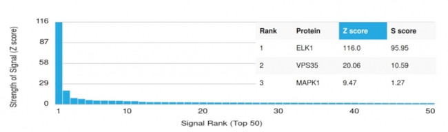 ELK1 Antibody in Peptide array (ARRAY)