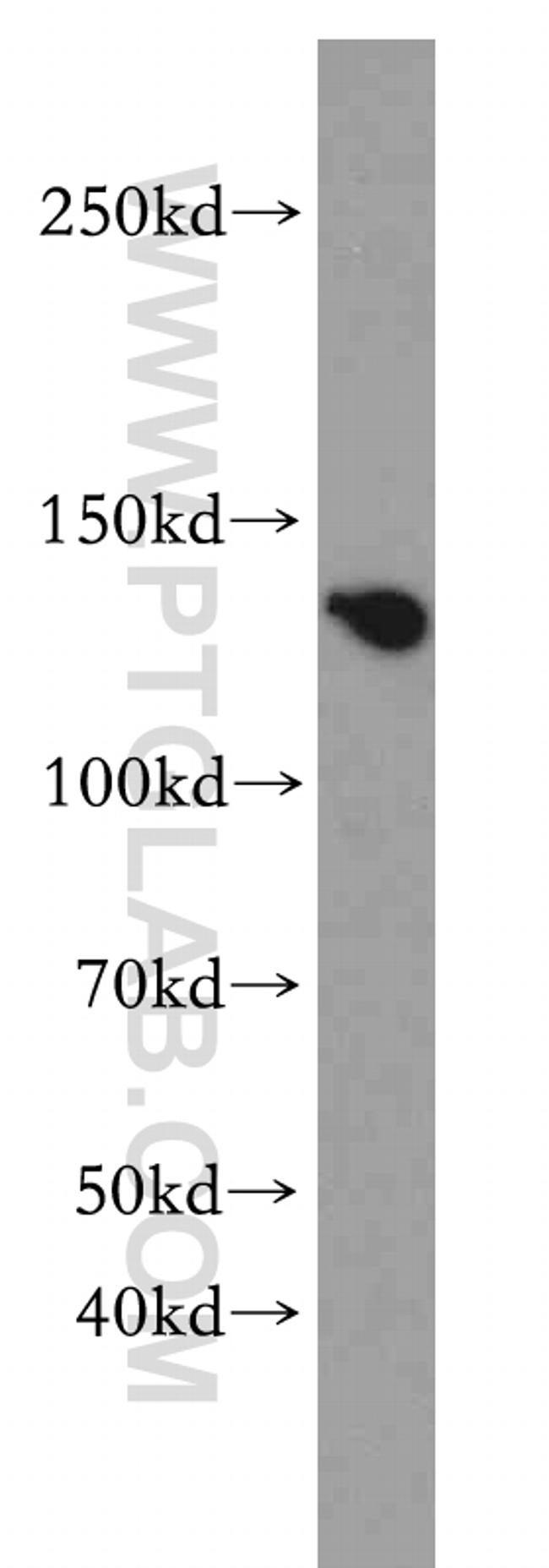 ZBTB40 Antibody in Western Blot (WB)