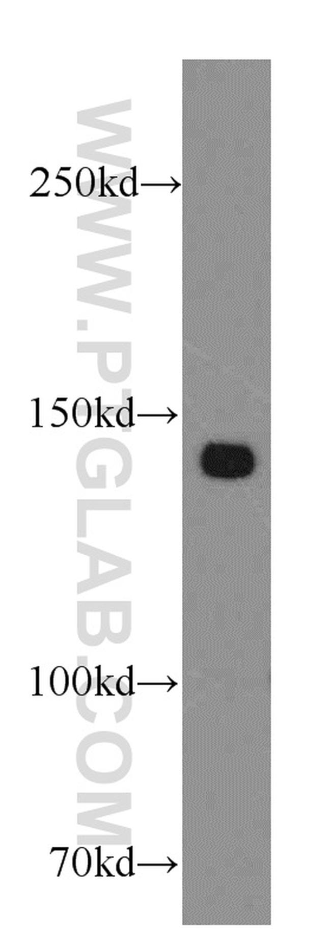 ZBTB40 Antibody in Western Blot (WB)