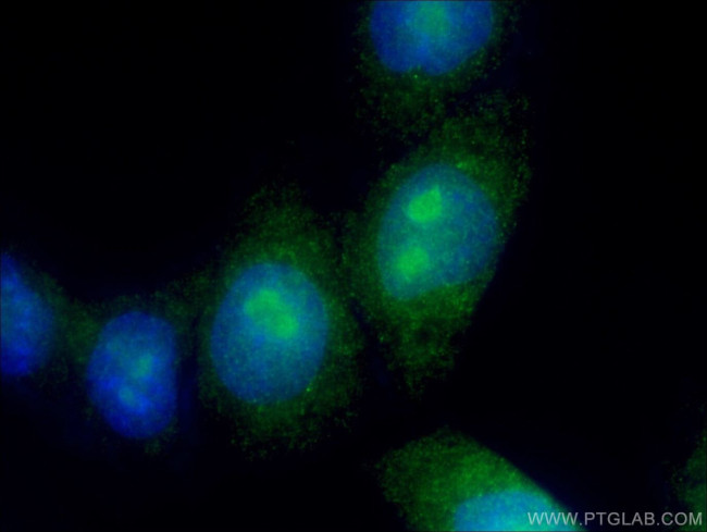 MED12 Antibody in Immunocytochemistry (ICC/IF)