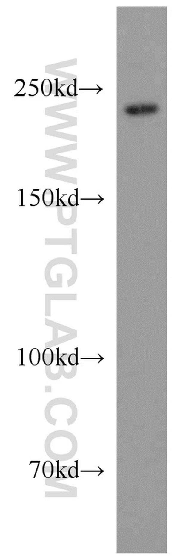 MED12 Antibody in Western Blot (WB)