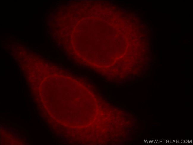 ZC3H4 Antibody in Immunocytochemistry (ICC/IF)