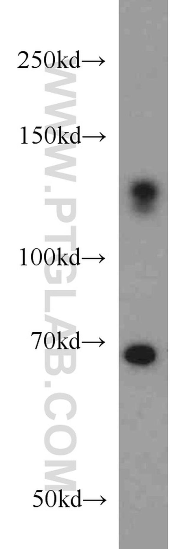 ZC3H4 Antibody in Western Blot (WB)