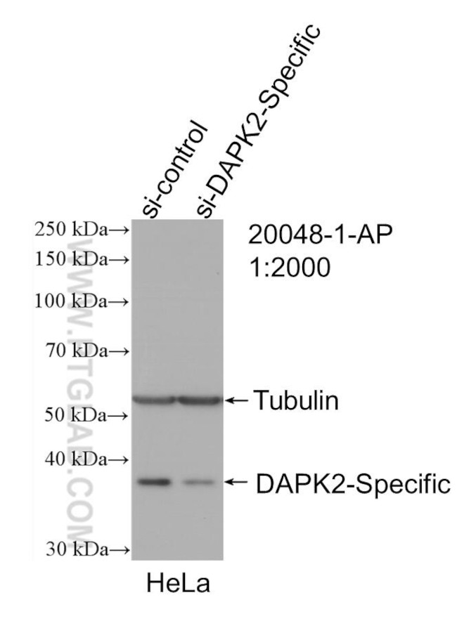 DAPK2 Antibody in Western Blot (WB)