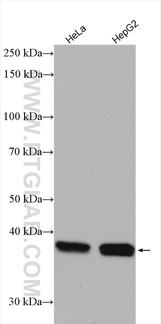 DAPK2 Antibody in Western Blot (WB)