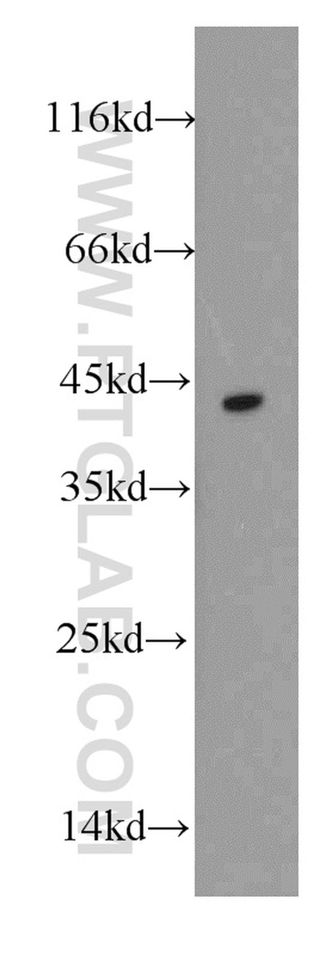 DAPK2 Antibody in Western Blot (WB)