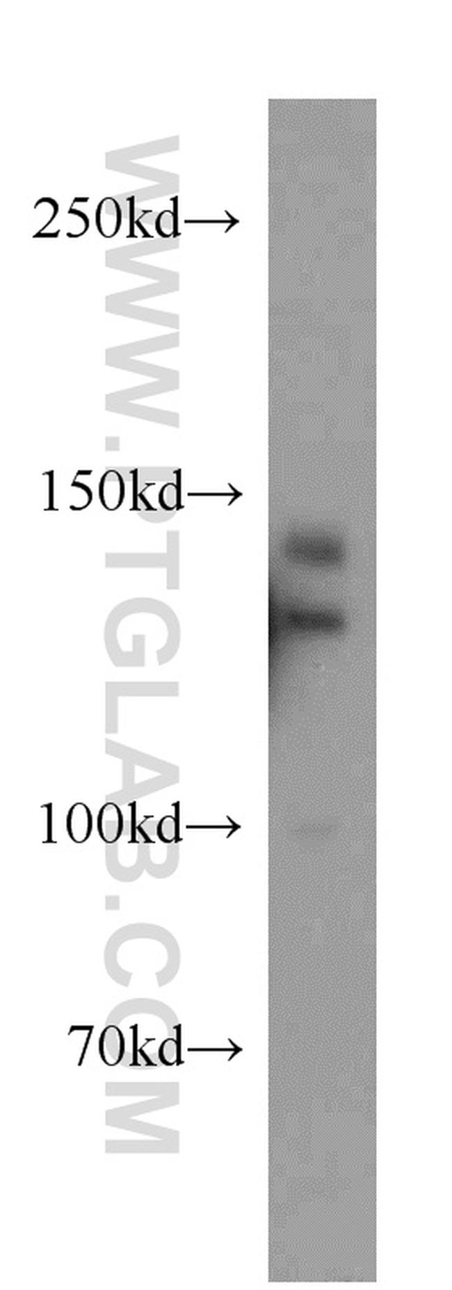 TRERF1 Antibody in Western Blot (WB)