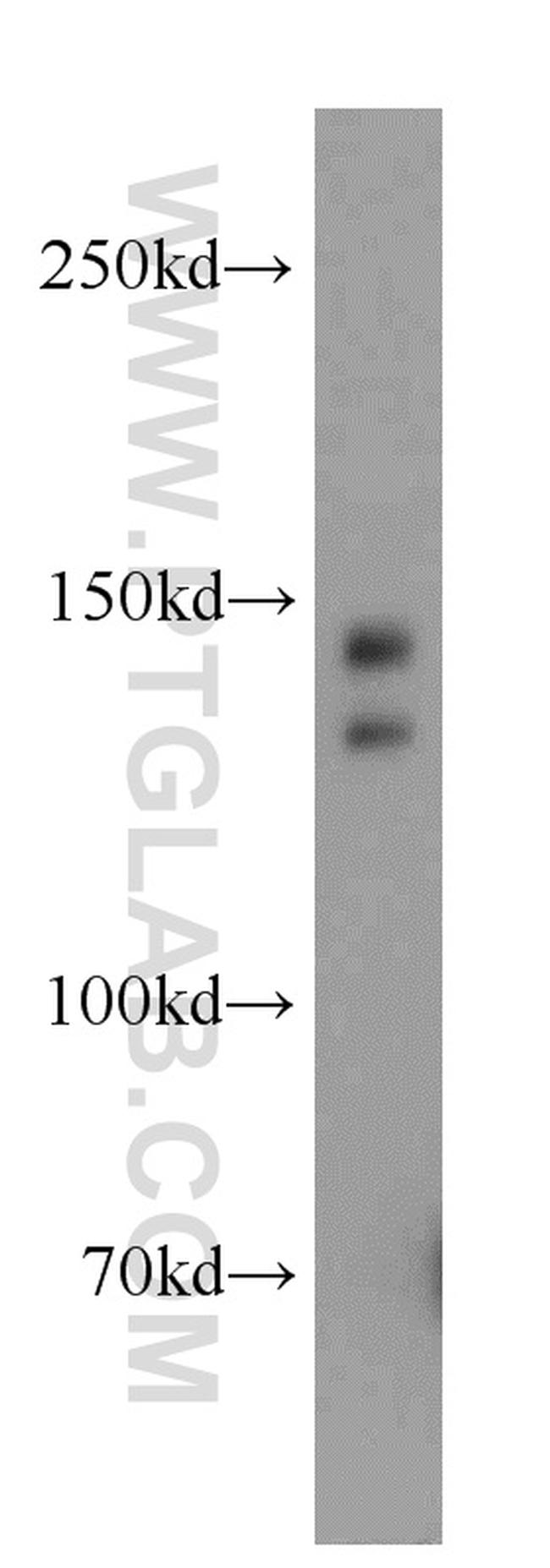 TRERF1 Antibody in Western Blot (WB)