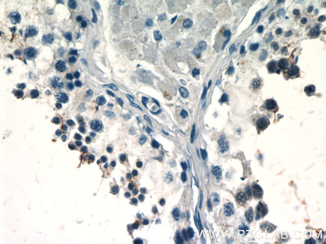 BAGE4 Antibody in Immunohistochemistry (Paraffin) (IHC (P))