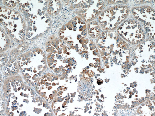 BAGE4 Antibody in Immunohistochemistry (Paraffin) (IHC (P))