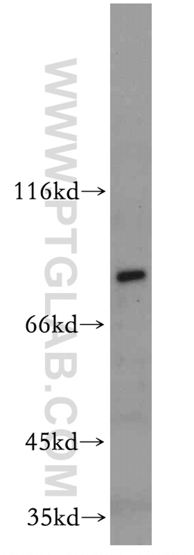 MYSM1 Antibody in Western Blot (WB)