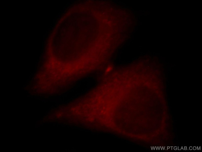 DGKK Antibody in Immunocytochemistry (ICC/IF)