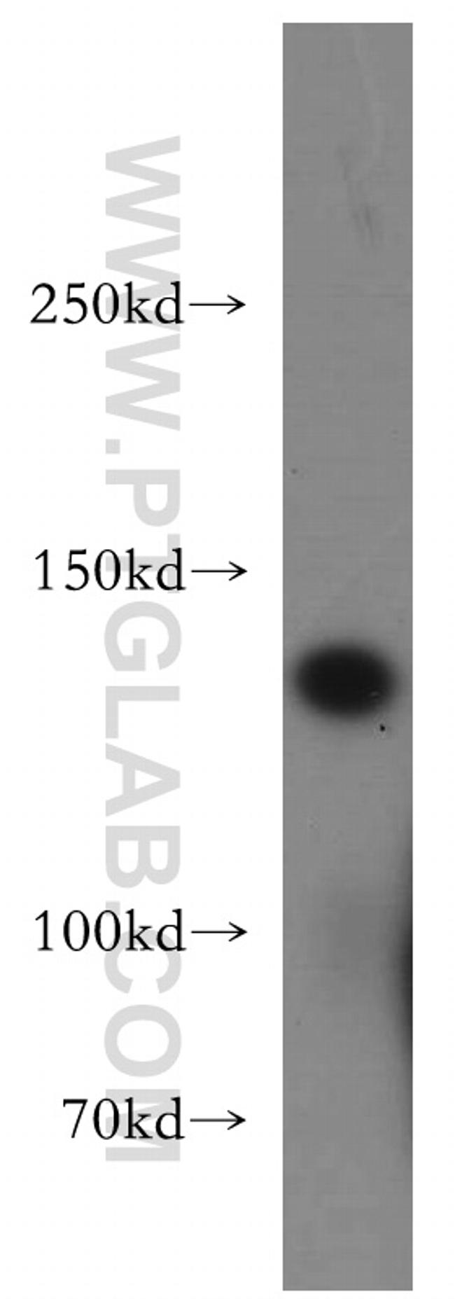 DGKK Antibody in Western Blot (WB)