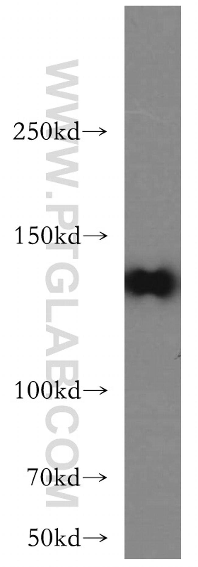 RIM2 Antibody in Western Blot (WB)