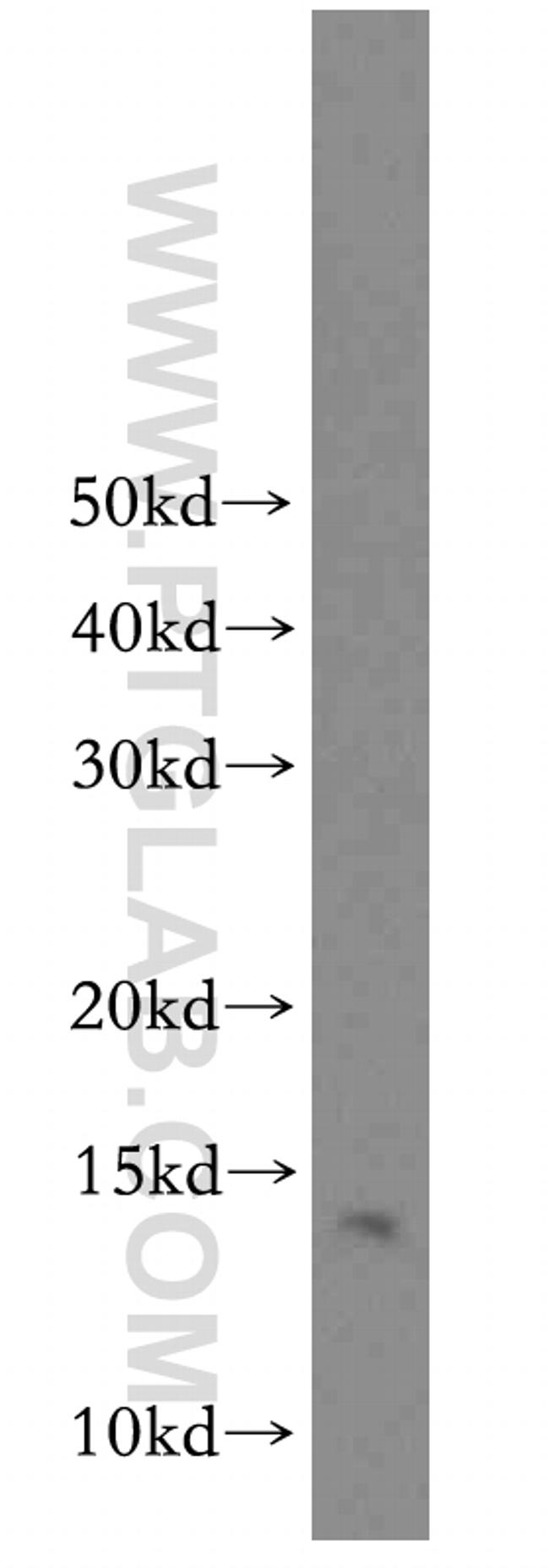 LDLRAD1 Antibody in Western Blot (WB)