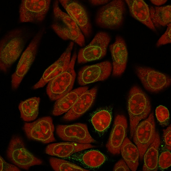 Emerin Antibody in Immunocytochemistry (ICC/IF)