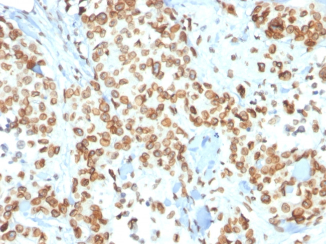 Emerin Antibody in Immunohistochemistry (Paraffin) (IHC (P))