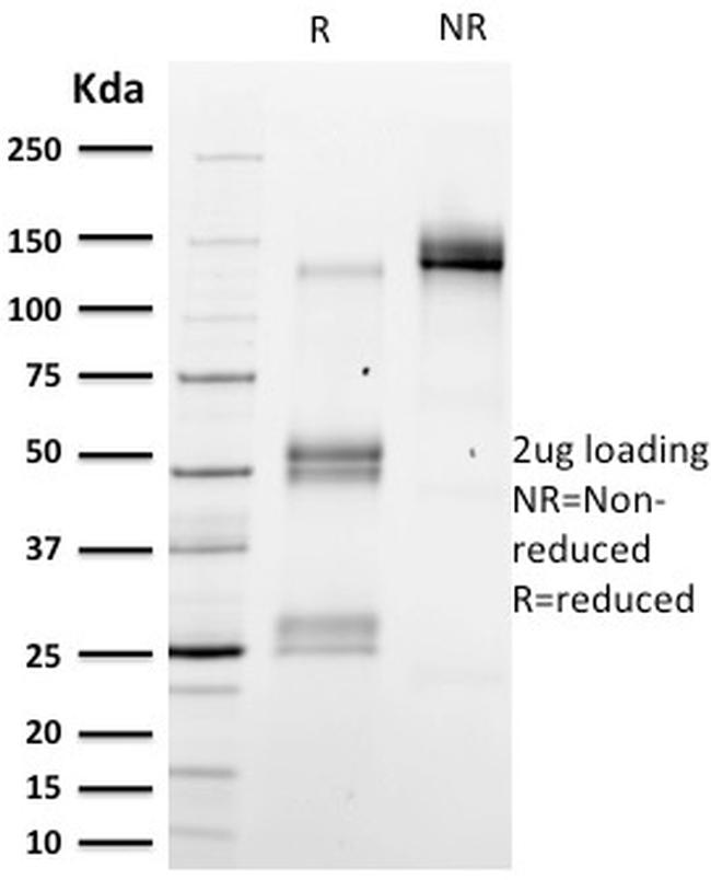 Emerin Antibody in SDS-PAGE (SDS-PAGE)