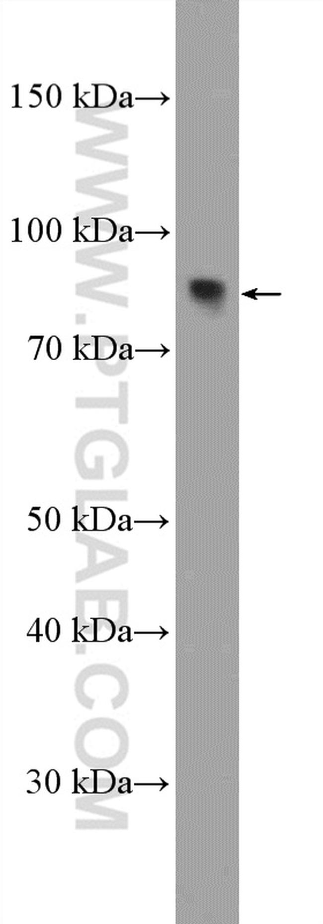 ZNF600 Antibody in Western Blot (WB)