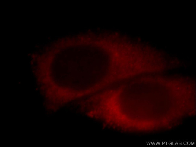 ACTR10 Antibody in Immunocytochemistry (ICC/IF)