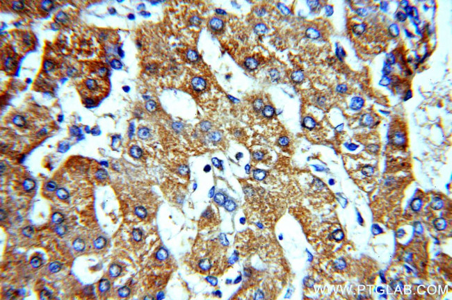 ACTR10 Antibody in Immunohistochemistry (Paraffin) (IHC (P))