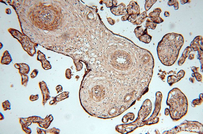 HAUS4 Antibody in Immunohistochemistry (Paraffin) (IHC (P))