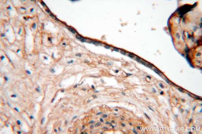 HAUS4 Antibody in Immunohistochemistry (Paraffin) (IHC (P))