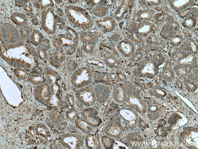 HAUS4 Antibody in Immunohistochemistry (Paraffin) (IHC (P))