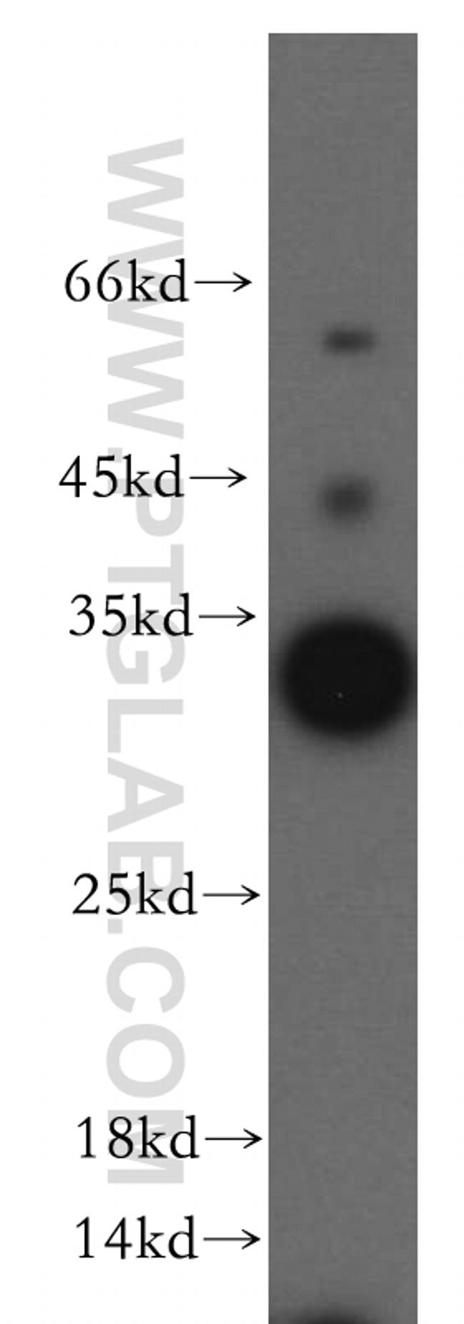 HAUS4 Antibody in Western Blot (WB)