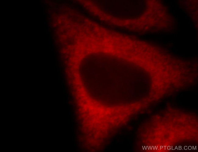 EEF2 Antibody in Immunocytochemistry (ICC/IF)