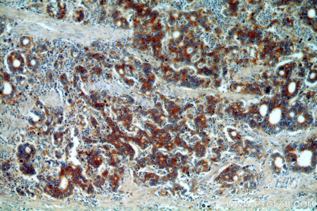 EEF2 Antibody in Immunohistochemistry (Paraffin) (IHC (P))