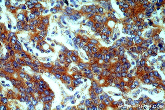 EEF2 Antibody in Immunohistochemistry (Paraffin) (IHC (P))