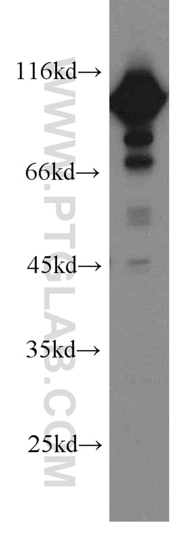 EEF2 Antibody in Western Blot (WB)