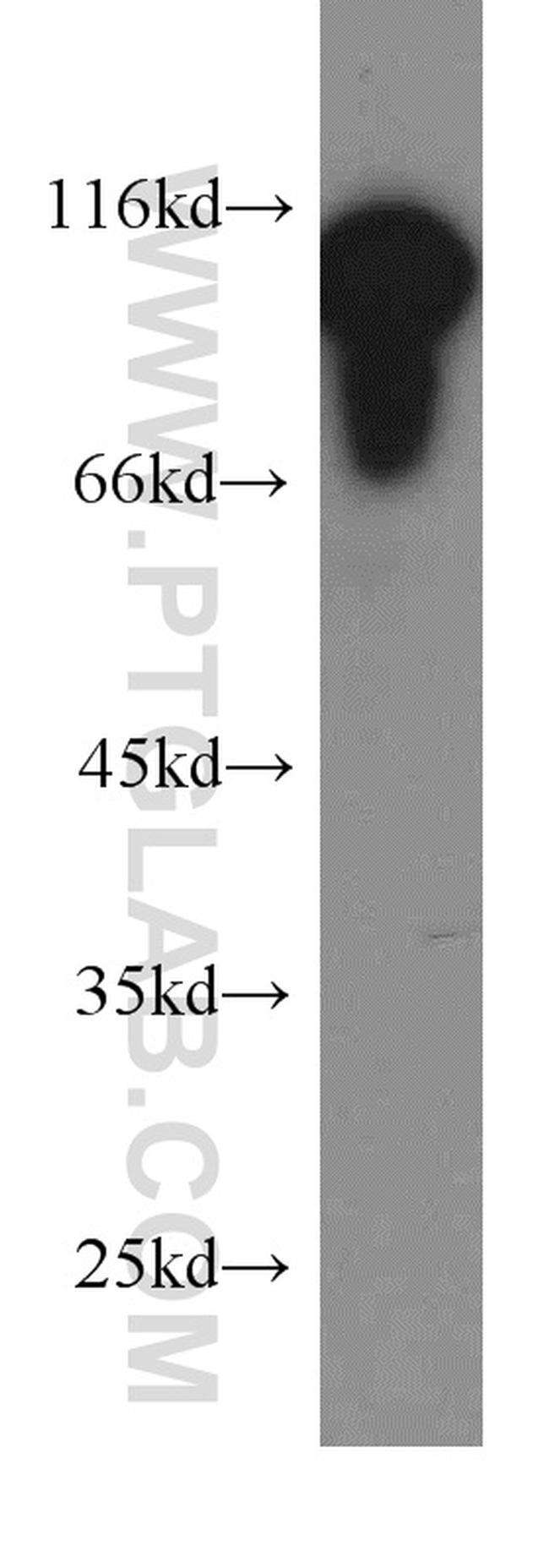 EEF2 Antibody in Western Blot (WB)