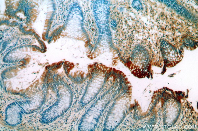 C18orf8 Antibody in Immunohistochemistry (Paraffin) (IHC (P))