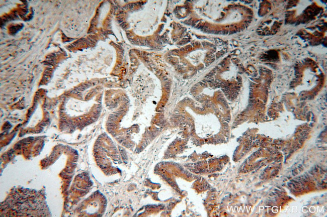 C18orf8 Antibody in Immunohistochemistry (Paraffin) (IHC (P))