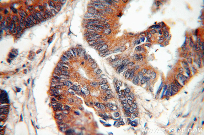 C18orf8 Antibody in Immunohistochemistry (Paraffin) (IHC (P))