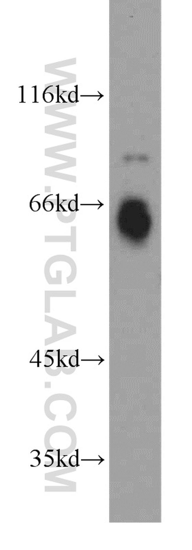 C18orf8 Antibody in Western Blot (WB)