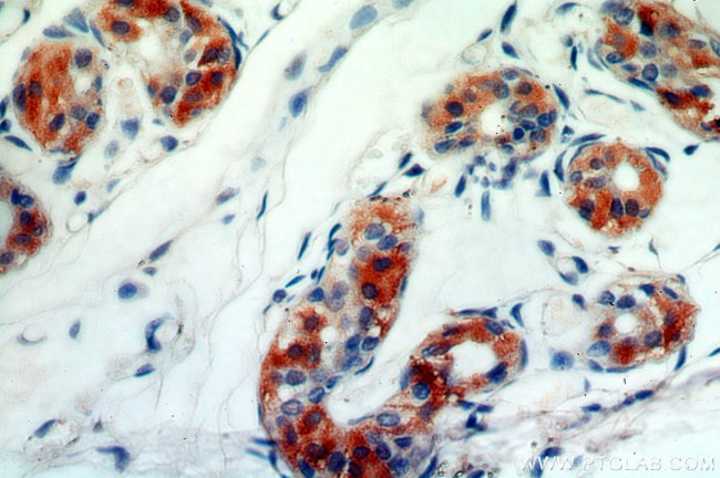 C14orf94 Antibody in Immunohistochemistry (Paraffin) (IHC (P))