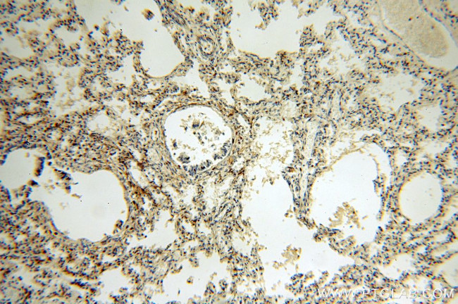 C14orf94 Antibody in Immunohistochemistry (Paraffin) (IHC (P))