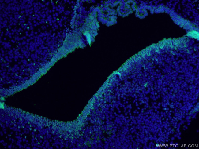 SOX2 Antibody in Immunohistochemistry (PFA fixed) (IHC (PFA))